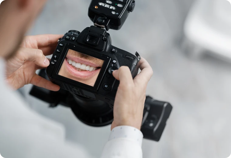 Prise de photographies cliniques de la bouche dans le cadre d'un bilan bucco-dentaire