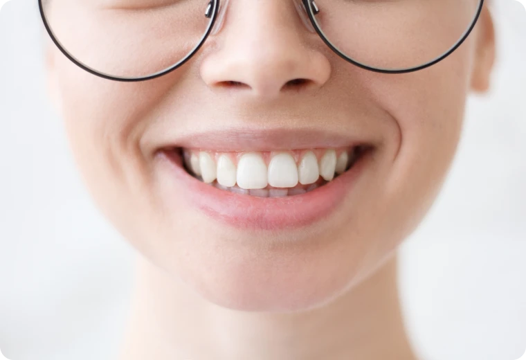 Sourire éclatant et dents blanches après un blanchiment dentaire